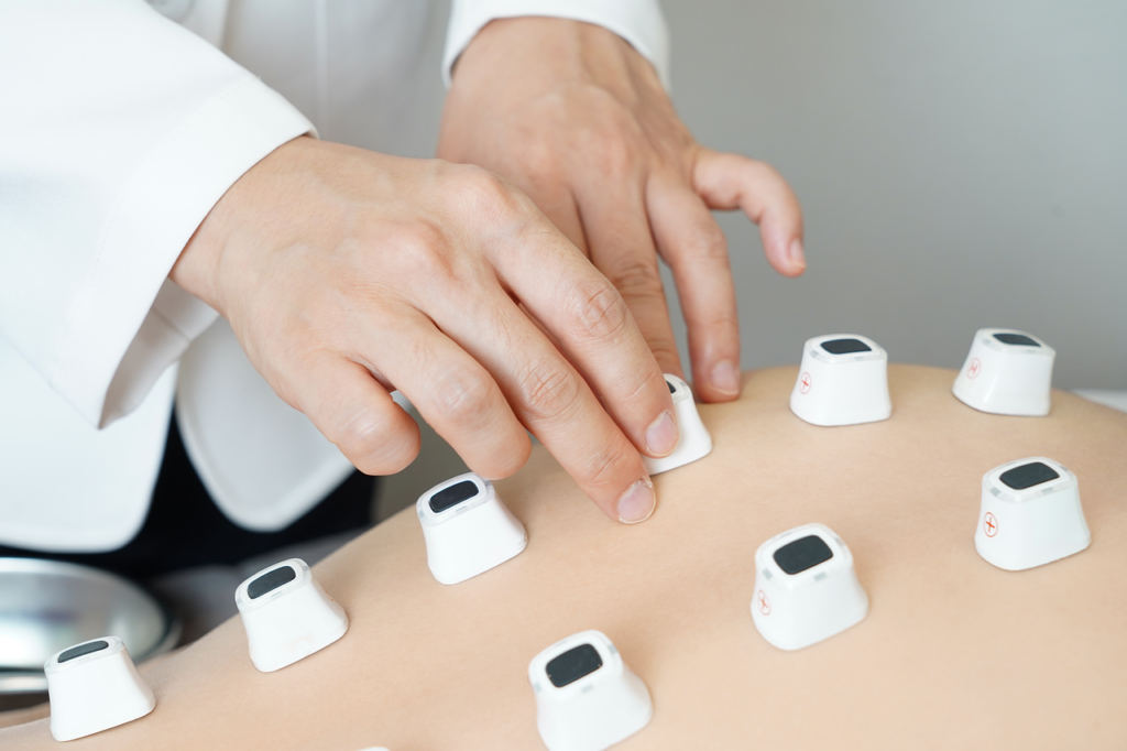 発毛クリニックでの注入治療の効果とは？