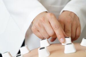 発毛クリニックでの治療効果はどれくらい期待できる？