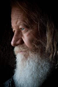 発毛クリニックの効果をビフォーアフターで徹底検証した結果は？